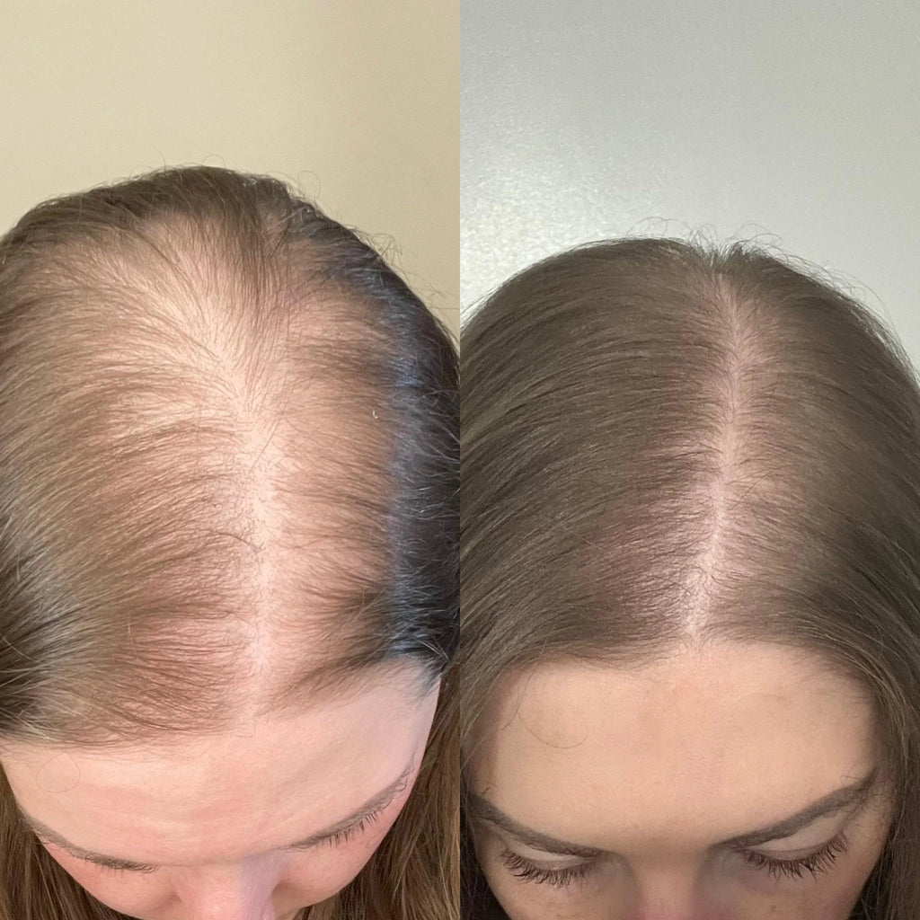 Advanced Hair Growth Roll-On Serum