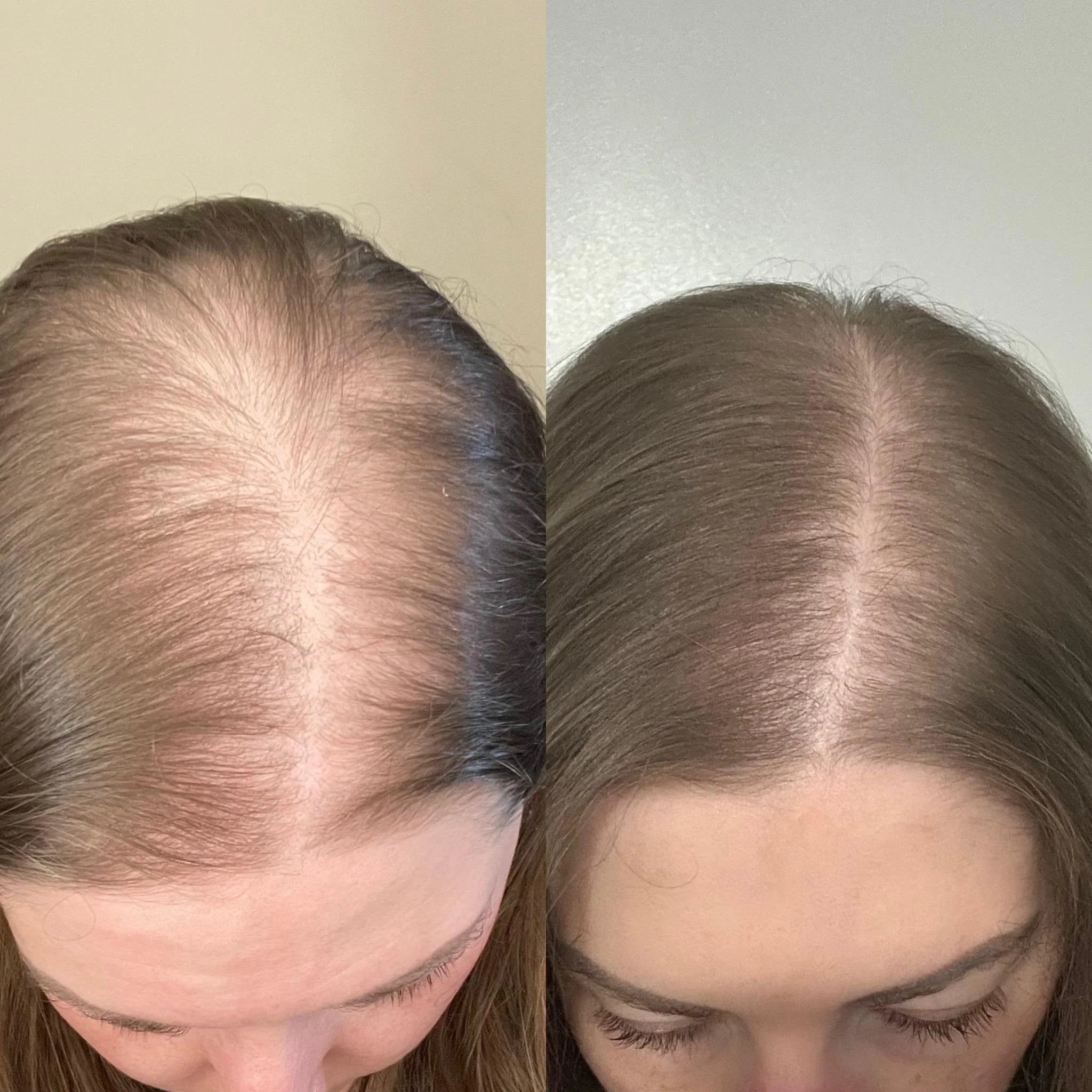 Advanced Hair Growth Roll-On Serum
