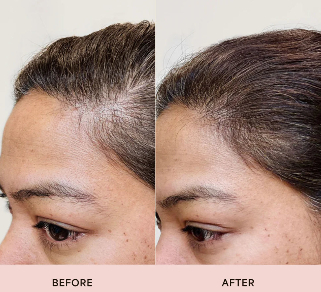 Advanced Hair Growth Roll-On Serum