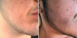 Before image