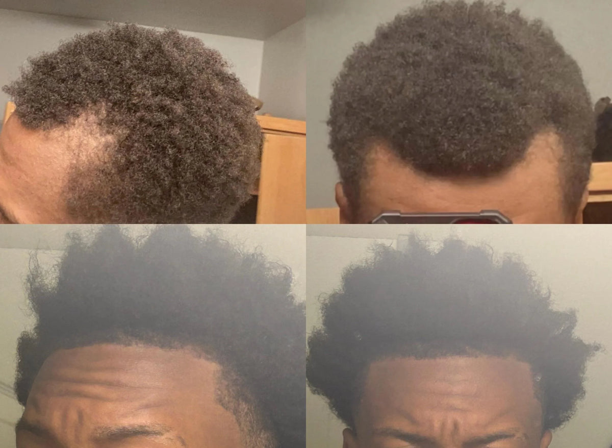Before image